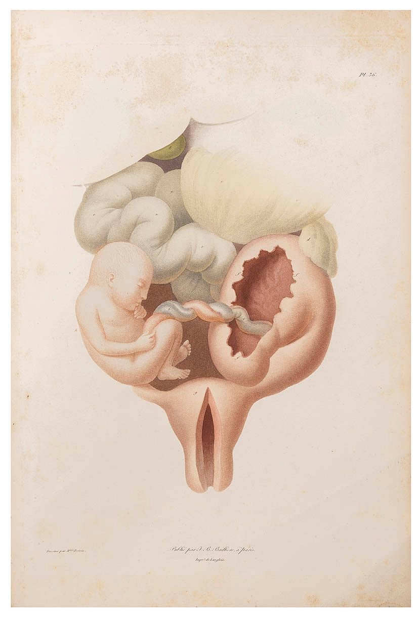 Antoine-Louis Dugès 2 Planche extraite du 22Traite pratique des maladies de lUterus et de ses annexes22 par Marie Boivin et Antoine Duges